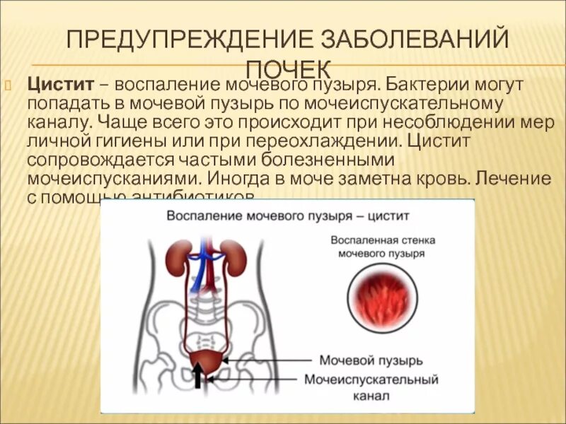 Заболевания почек и мочевого пузыря. Профилактика заболеваний мочевого пузыря. Бактерии в мочевом пузыре.