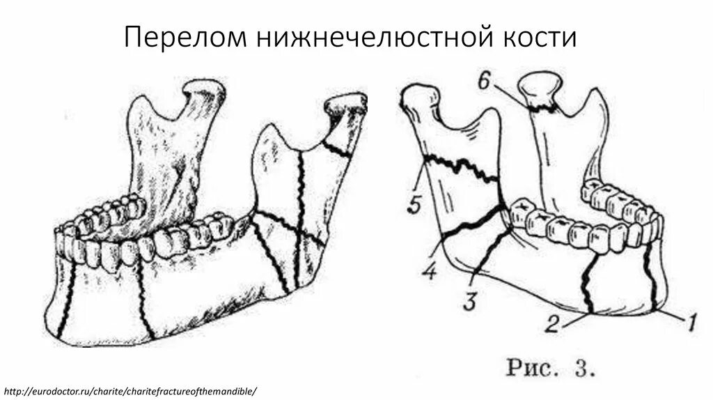 Нижнечелюстная кость парная