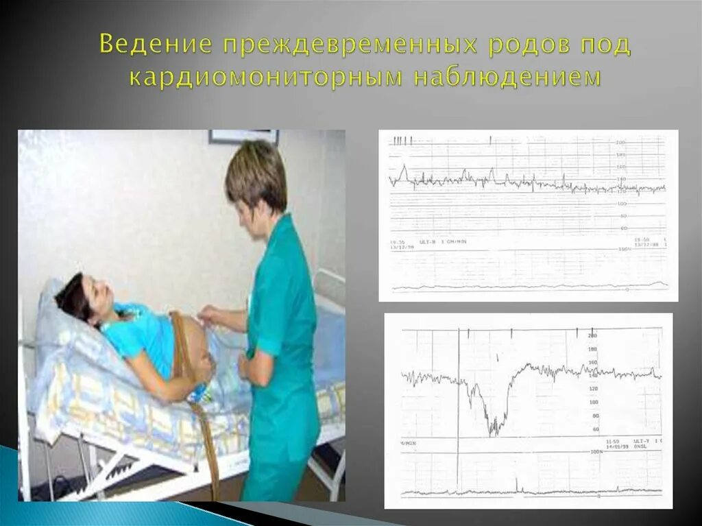 Программа роды