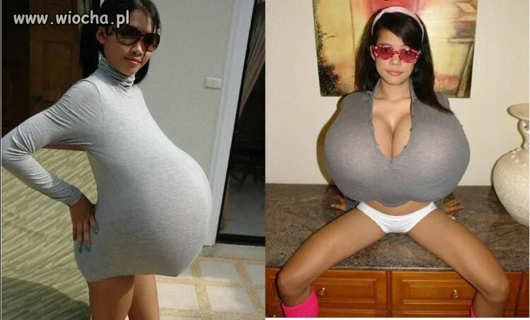 Sykosa-nakos, as it happened: stars with unsuccessful breast plastic http://www.