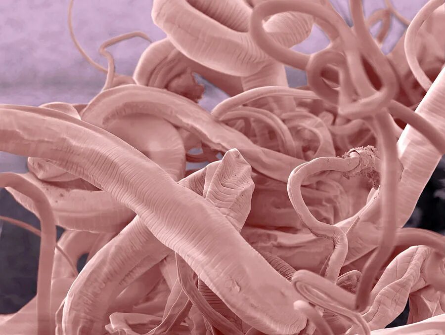 Яйца остриц под микроскопом. Яйца остриц микроскопия. Нематоды эустронгилидесы. Гельминты микроскоп. Яйца глистов под микроскопом в кале.