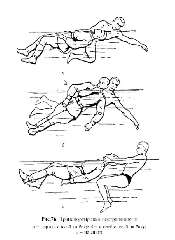 Спасение утопающего человека. Спасение утопающего схема. Способы транспортировки пострадавшего на воде. Способы транспортировки утопающего. Способы транспортировки тонущего человека.
