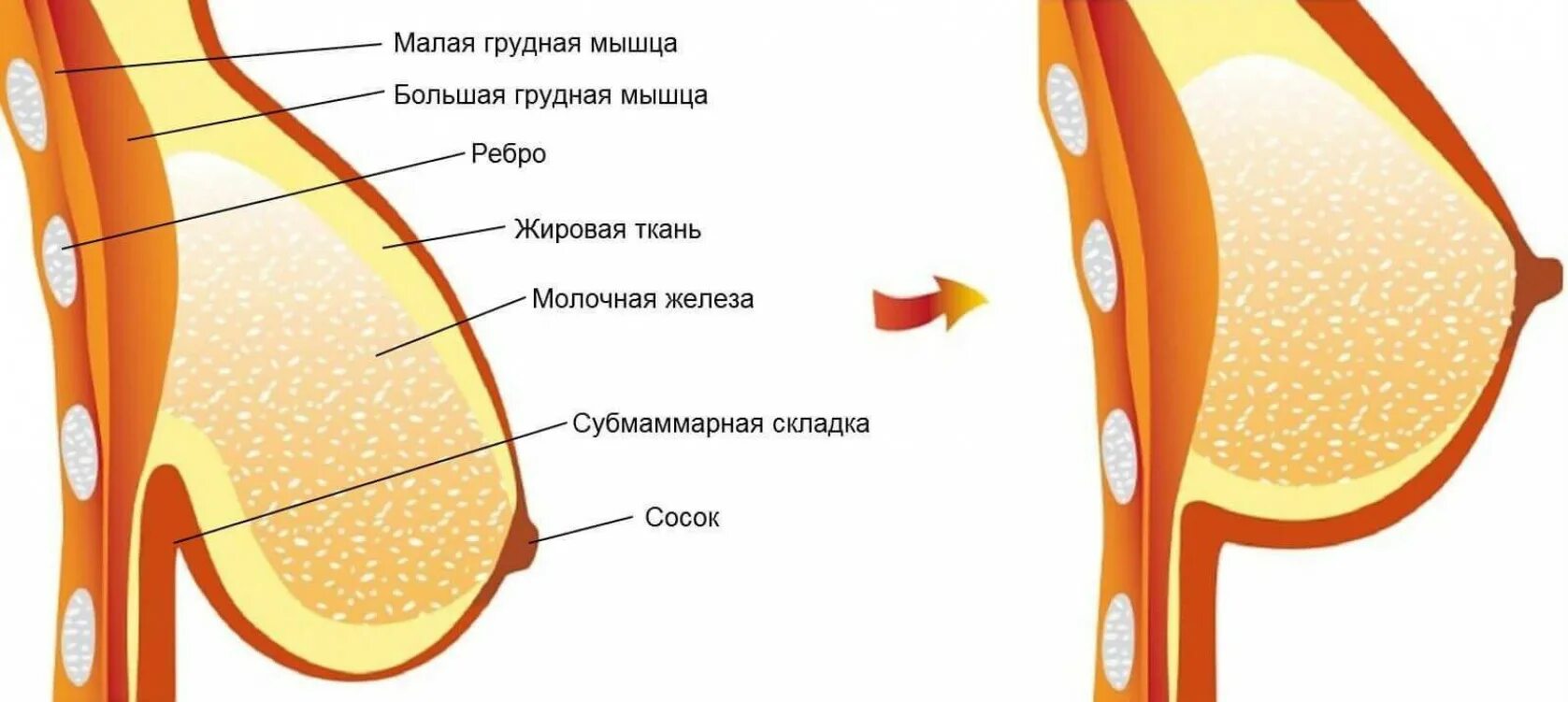 Изменение молочных желез. Строение молочной железы ореола. женская грудь в разрезе. из чего состоит женская грудь.