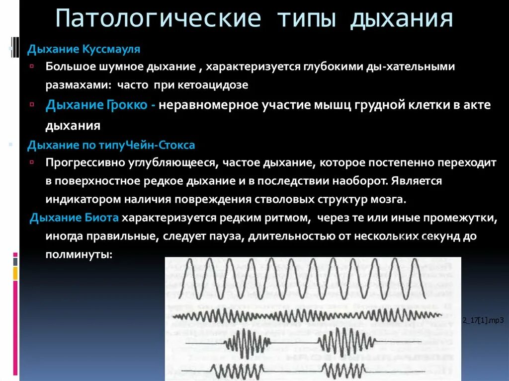 Легочный тип дыхания характерен. Дыхание Биота Чейна Стокса Грокка. Дыхание Куссмауля Биота. Дыхание Биота Чейна Стокса Куссмауля. Типы дыхания Куссмауля Чейна Стокса Биота.