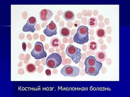 Пролиферация клеток костного мозга