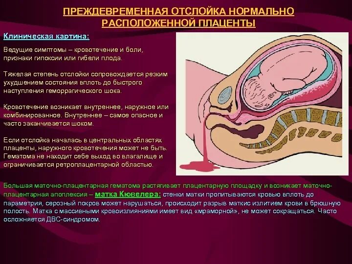 Секс Во Время Беременности Отзывы