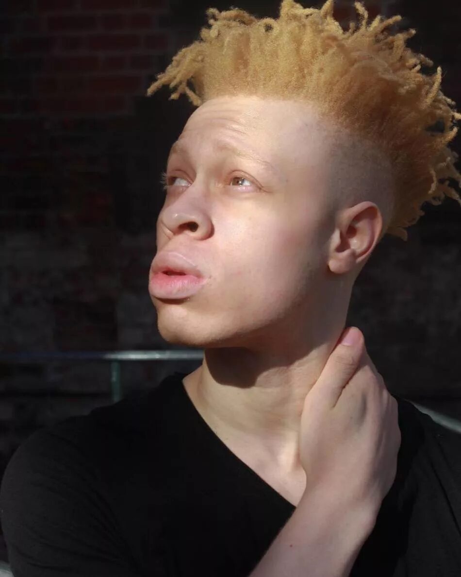 Белый негр. Негр альбинос актер. Афроамериканец альбинос. Лео Джона. Джуэл Джеффри фотомодель альбинос.