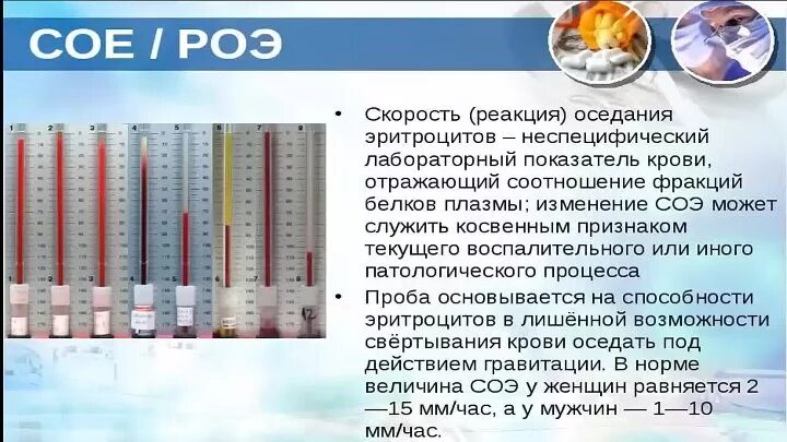 Что означает соэ в крови у мужчин. Исследование крови Роэ норма у детей. СОЭ Роэ норма. Скорость реакции оседания эритроцитов норма. СОЭ 50 мм в час.