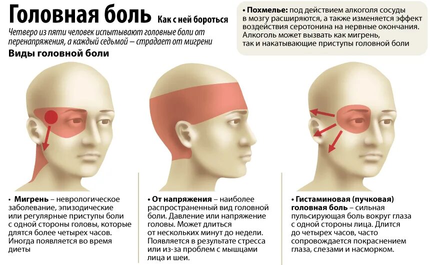 Онемевший затылок. Виды головной боли. Локализация глазной боли. Боль в висках головы. Мигрень и головная боль напряжения.