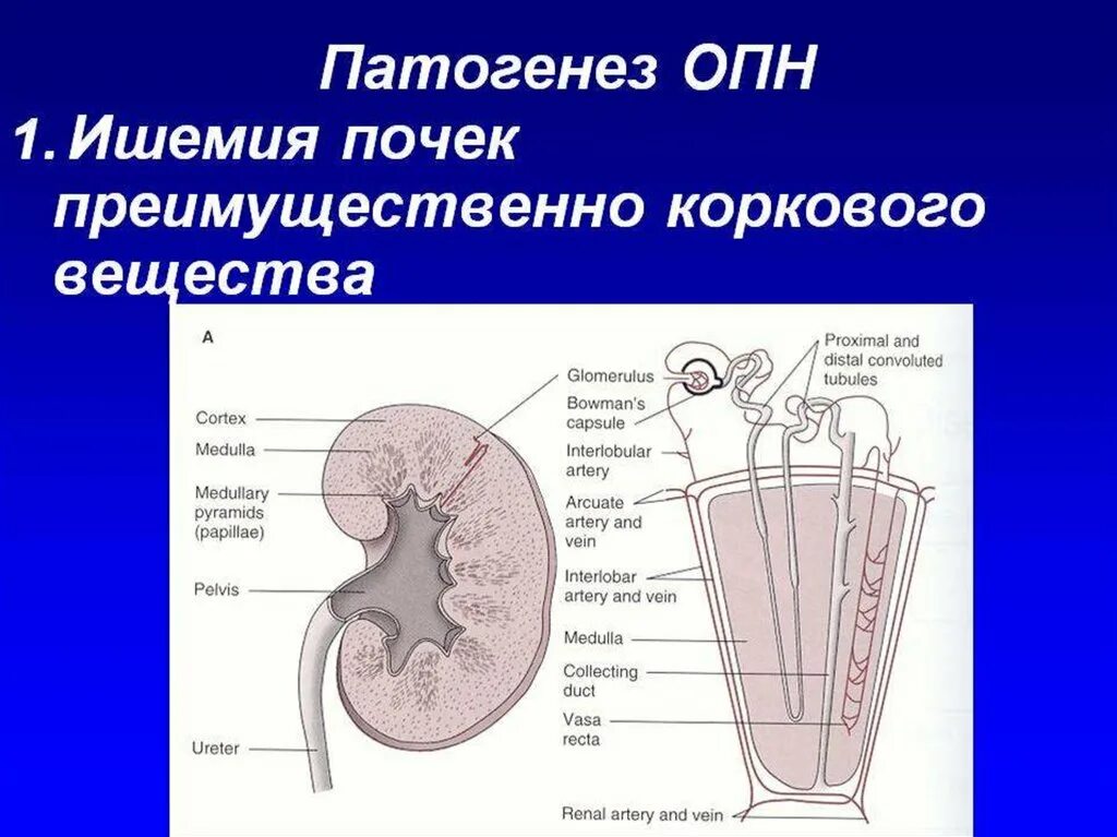 Влияние белков на почки. Острый гломерулонефрит почка. Нефропатия гравидарум. Ишемическая почка. Острая почечная недостаточность механизм развития.