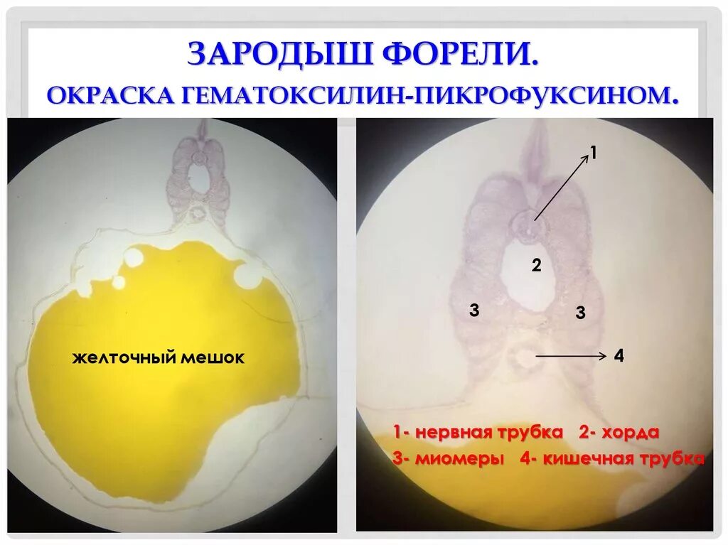 Желточный мешок гистология. Желточный мешок гистология препарат. зародыш форели с желточным мешком. зародыш форели гематоксилин-пикрофуксин. строение зародыша форели с желточным мешком.