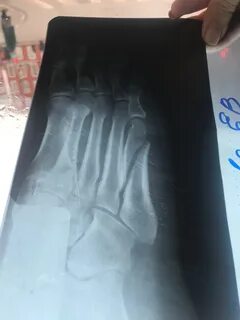 Сломано 5