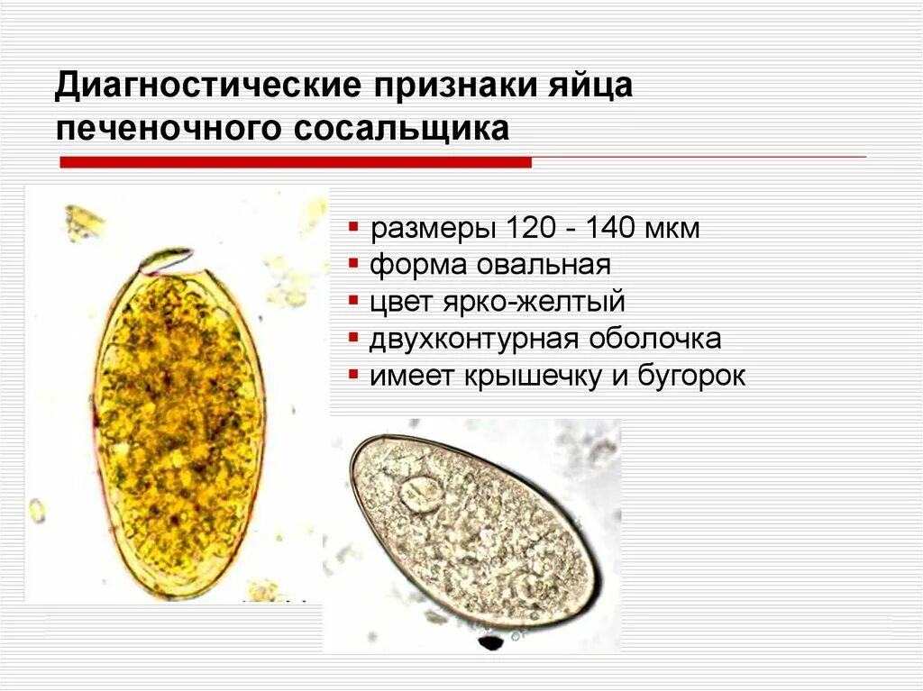 Печеночный сосальщик являющийся. Яйца ланцетного сосальщика. Яйцо кошачьег сосальщика препарат. Яйца ланцетовидного сосальщика препарат. Строение яйца печеночного сосальщика.