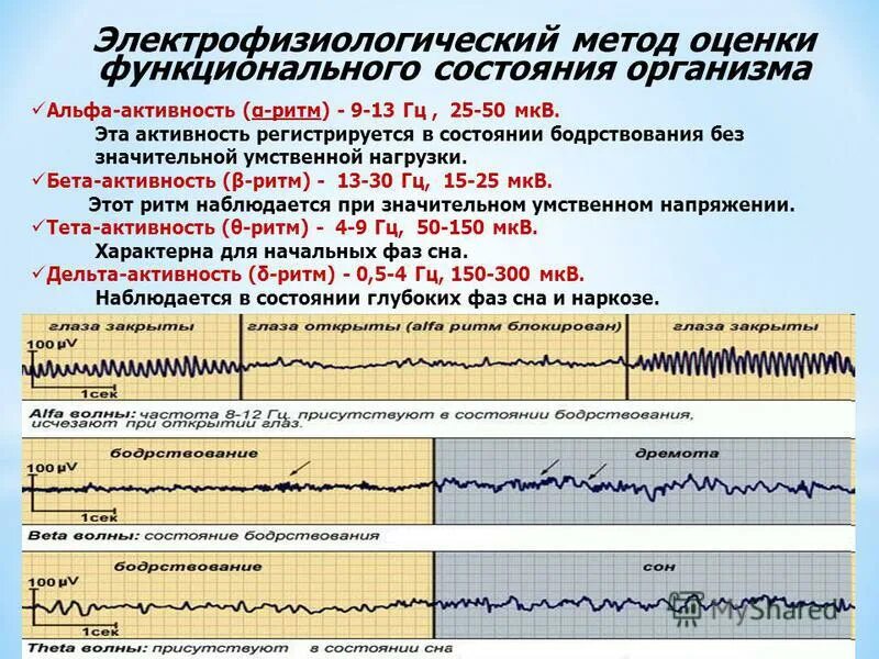 Функциональное состояние организма. Альфа активность. Бета активность. Состояние бодрствования. Альфа бета активность