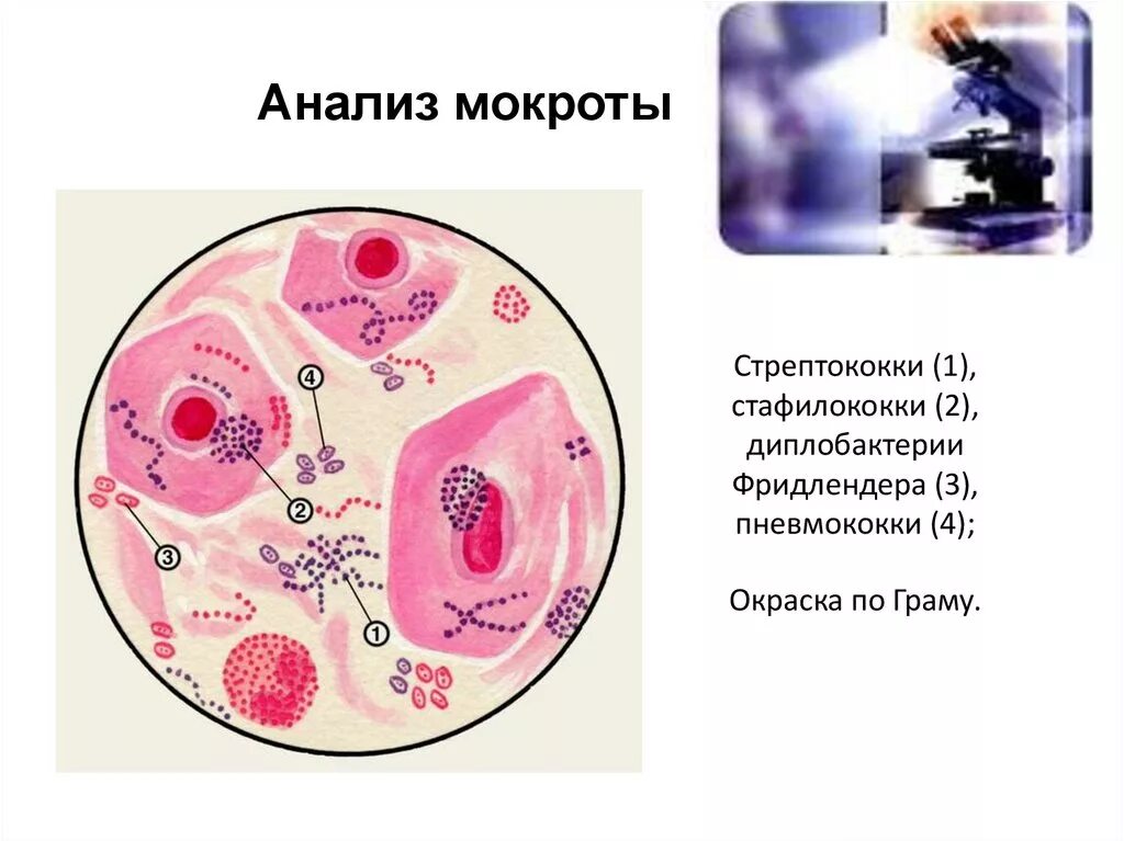 Стафилококк в мокроте