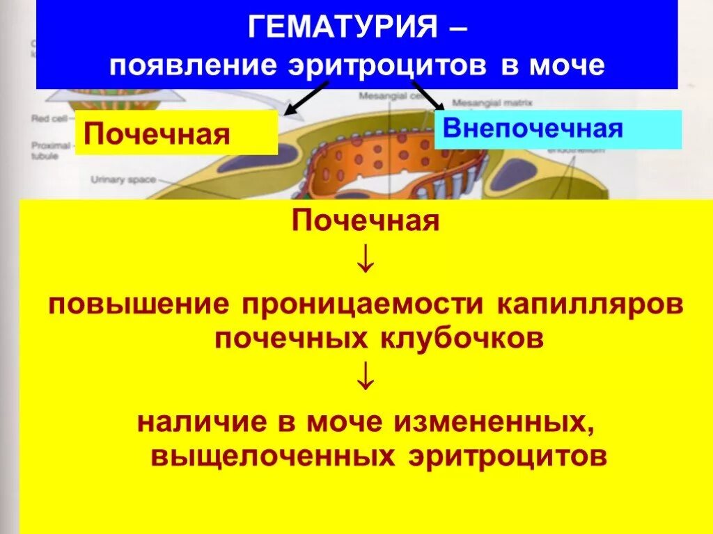 Гематурия это появление. Гематурия причины возникновения. почечная и внепочечная гематурия. гематурия почечная моча. внепочечная гематурия.
