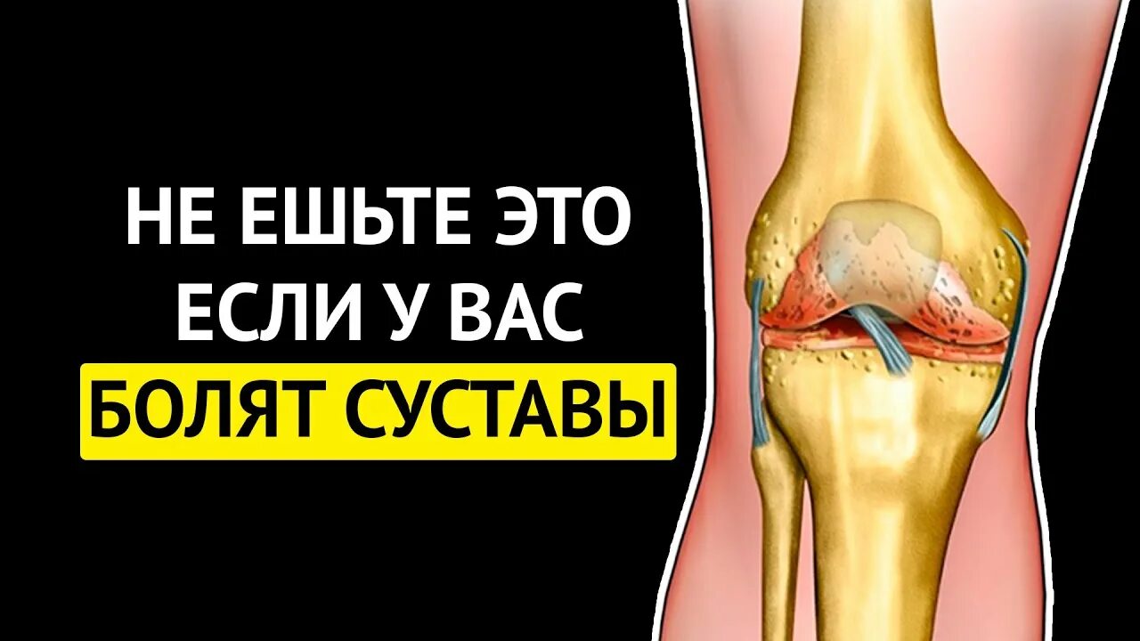 Продукты разрушающие суставы. Продукты вредные для суставов и хрящей. полезные продукты для суставов и хрящей и костей. не ешьте это, если у вас болят суставы. продукты для суставов и связок и хрящей восстановления.