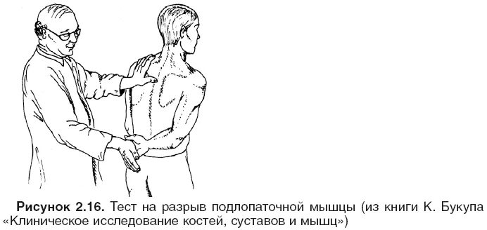 Тест на травмы первый. Подлопаточная мышца тестирование. Тест подлопаточной мышцы. Повреждение подлопаточной мышцы. Разрыв подлопаточной мышцы.