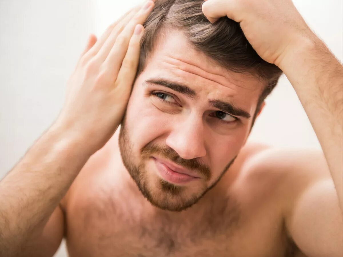 Здоровые волосы у мужчин. Выпадение волос у мужчин. Поредевшие волосы у мужчин. Чистые волосы у мужчин. Волосы дают мужчине