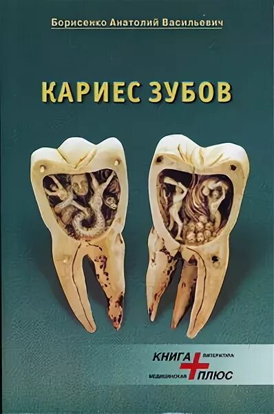 Лечение кариеса книги