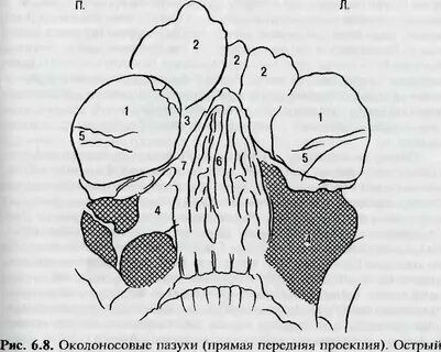 Решетчатой верхнечелюстной