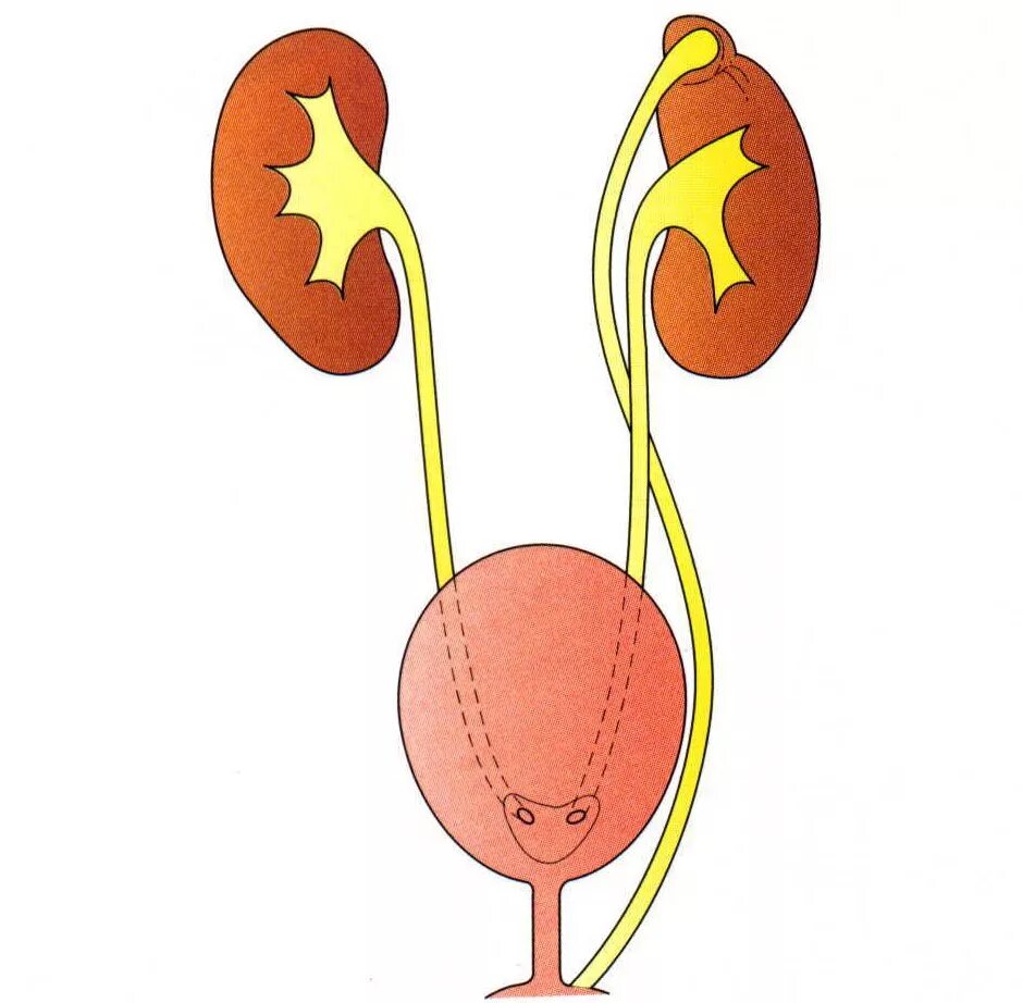 Мочеточник почечная лоханка мочеиспускательный канал мочевой пузырь. Эктопия устья мочеточника. Почки мочеточники мочевой пузырь. Почки мочеточники мочевой пузырь анатомия. Эктопия устьев мочеточников это.