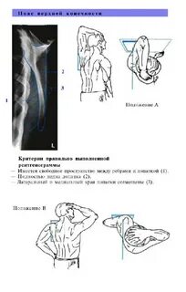 Рентгенологические укладки
