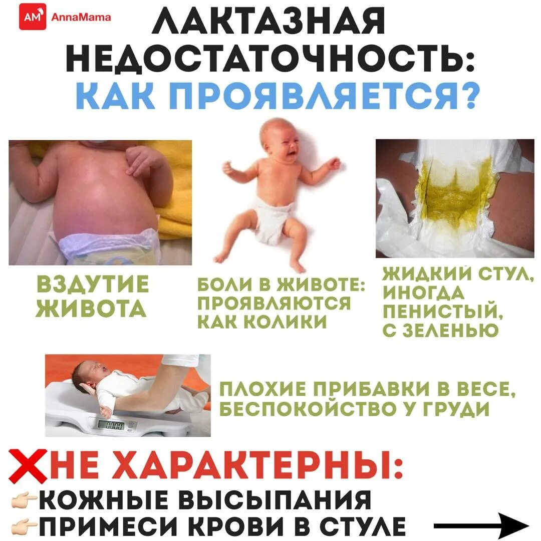 Симптомы лактазной недостаточности у грудничка. Лактазная недостаточность у грудничка симптомы. лактазная недостаточность у грудничка стул. лактазная недостаточность у новорожденного симптомы. симптомы лактазной недостаточности у ребенка.