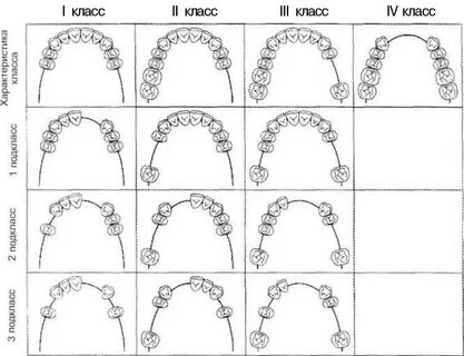 Классификация кеннеди