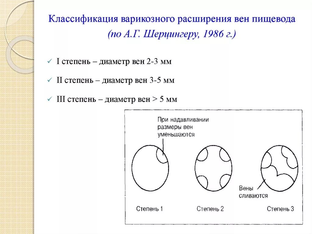 Варикозно расширенные вены желудка классификация. Расширение вен пищевода по Шерцингеру. Варикозное расширение вен пищевода классификация. Классификация варикозно расширенных вен пищевода по paquet.