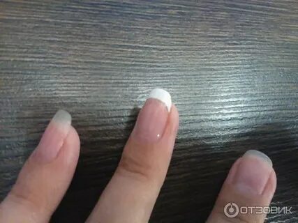 Аллергия на уф лампу