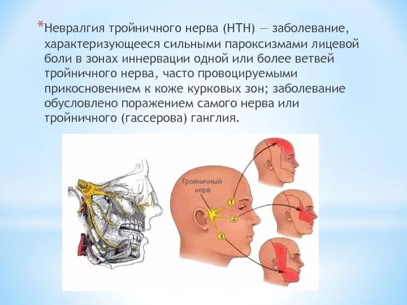 Поражение ветвей тройничного нерва. Невралгия ветвей тройничного нерва симптомы. Симптомы поражения тройничного нерва неврология. Симптомы поражения 2 ветви тройничного нерва. Воспаление нерва можно ли греть