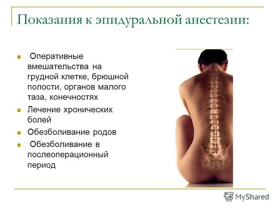 Боль в пояснице после спинномозговой анестезии. Эпидуральная анестезия. Спинальная и эпидуральная анестезия. Спина после эпидуральной анестезии. Боль в спине после операции