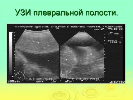 Где сделать узи легких