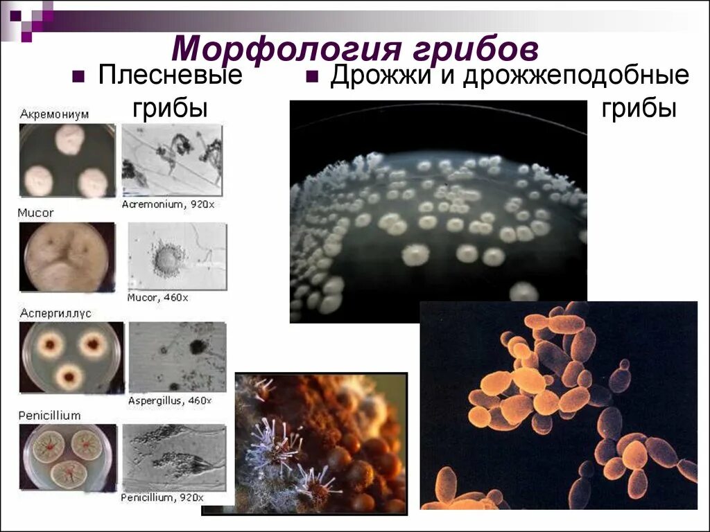 Оборудование для изучения клеток дрожжевых грибов. Классификация грибов микробиология дрожжевых. Морфология грибов микробиология дрожжевые. Морфология грибов гифальные дрожжевые микробиология. Структура дрожжевых грибов микробиология.