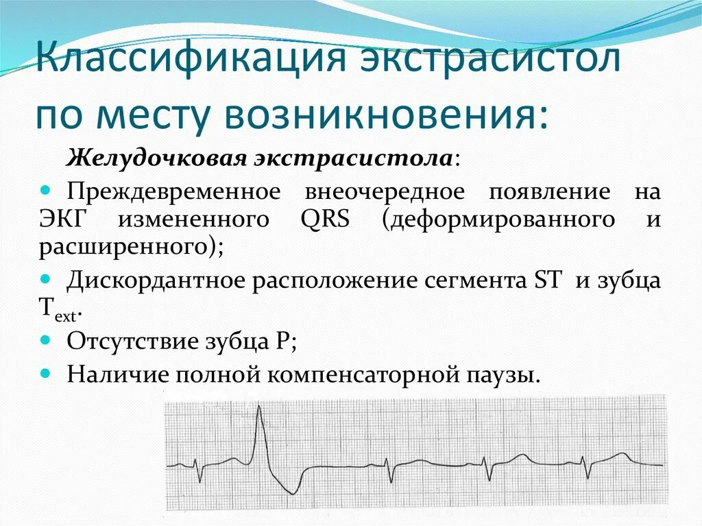 Механизм возникновения желудочковой экстрасистолы. Механизм возникновения наджелудочковой экстрасистолии. Полиморфная желудочковая экстрасистолия. Замещающая желудочковая экстрасистолия. Экстрасистолы врачам