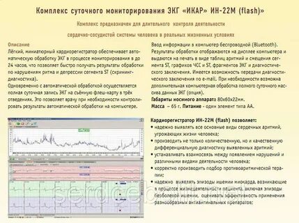 Экг отзывы