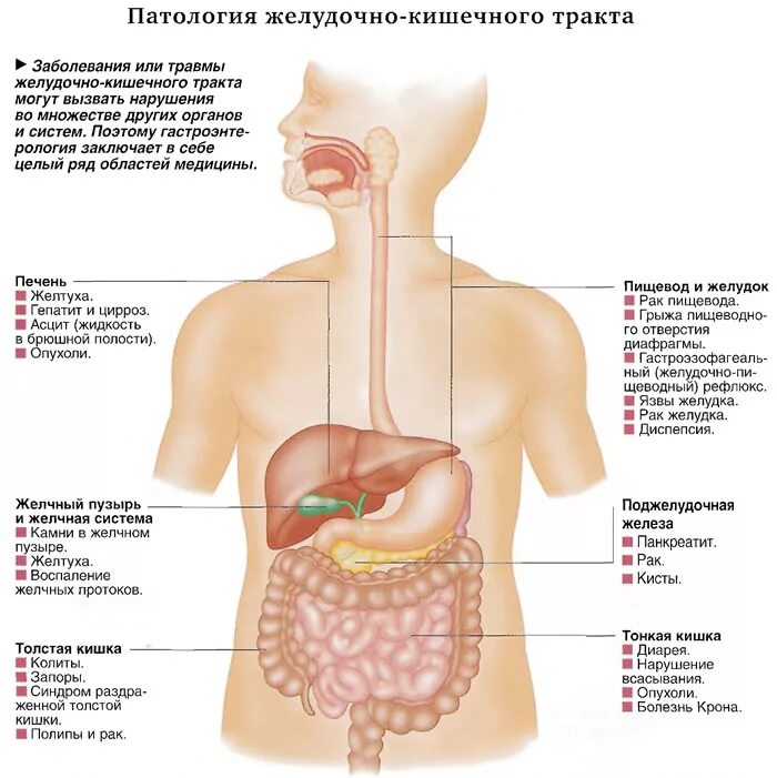 Признаки заболевания пищеварительного тракта. Симптомы при патологии желудочно кишечного тракта. Основные симптомы при заболеваниях желудочно-кишечного тракта. "Патология ЖКТ" ЖКТ патология.