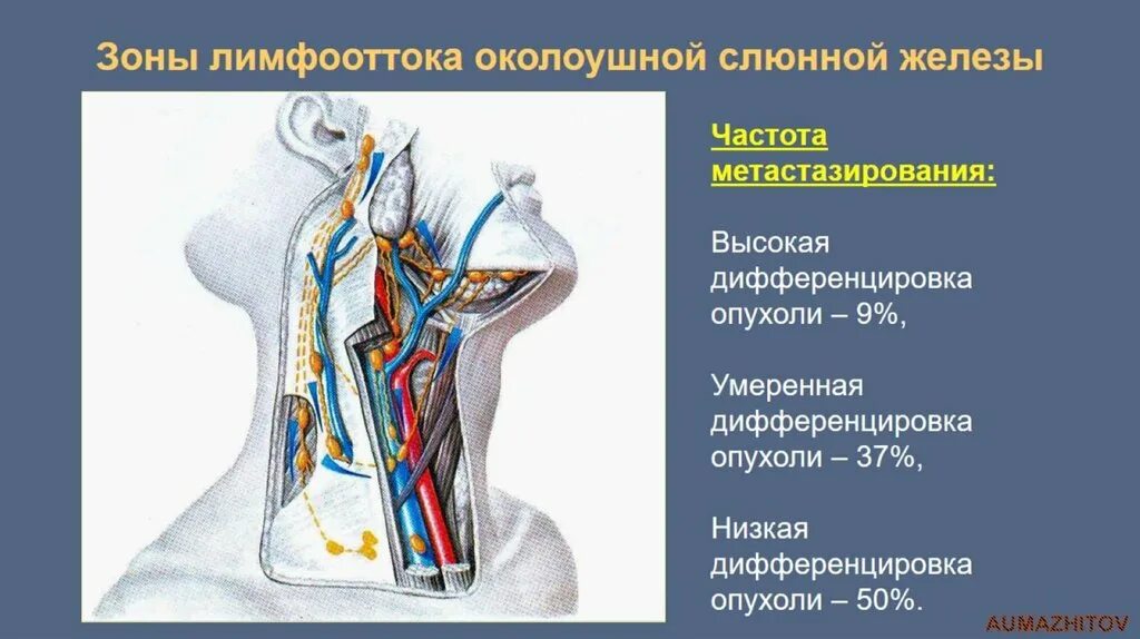 Околоушные лимфоузлы анатомия. Слюнные железы лимфоотток. Лимфоузлы околоушной слюнной железы. Околоушная железа анатомия. Операции околоушная железа