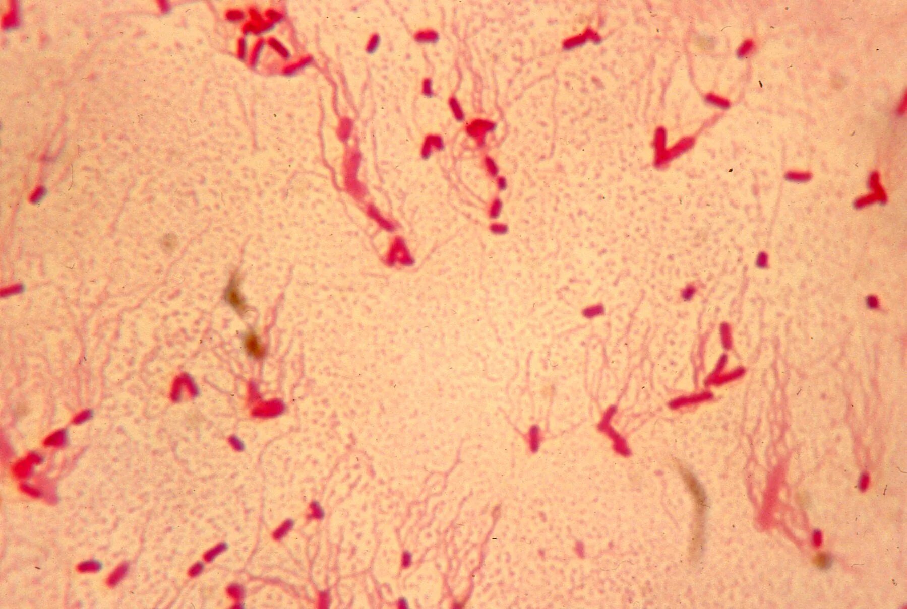 Disease of the Week - Salmonella Public health, Health department, Health