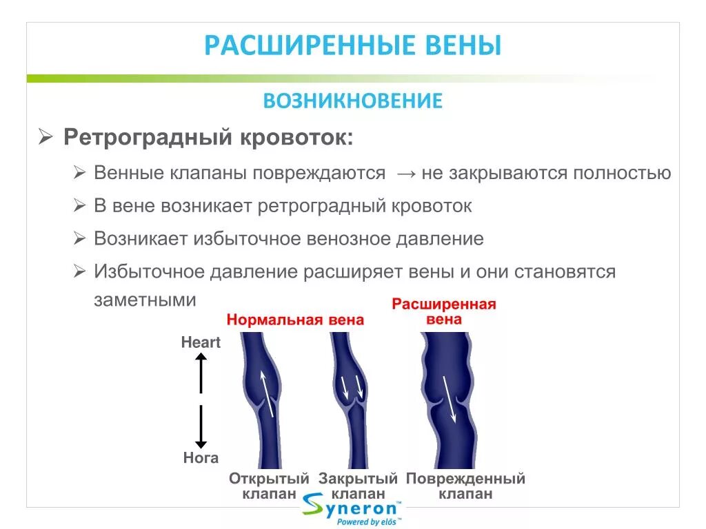 Ретроградная вена. Внутренняя яремная вена катетеризация. Ретроградная вена. Эндоскопическая диссекция перфорантных вен нижних конечностей. Ведущий фактор патогенеза.