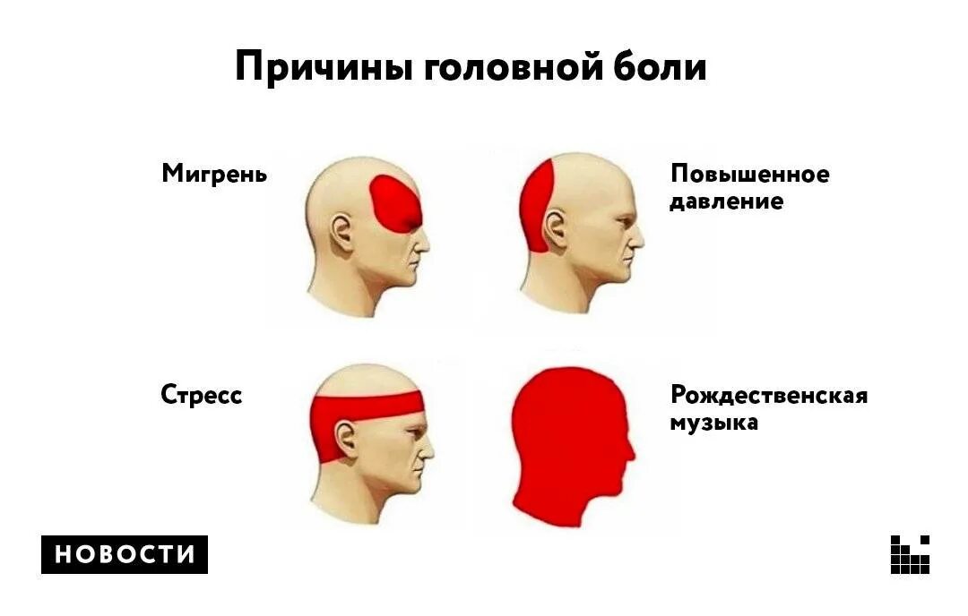 Сильная боль в лобной части. Причины головной боли. Причины головнгйьболи. Головная боль в затылке. Сильно болит лоб и затылок.