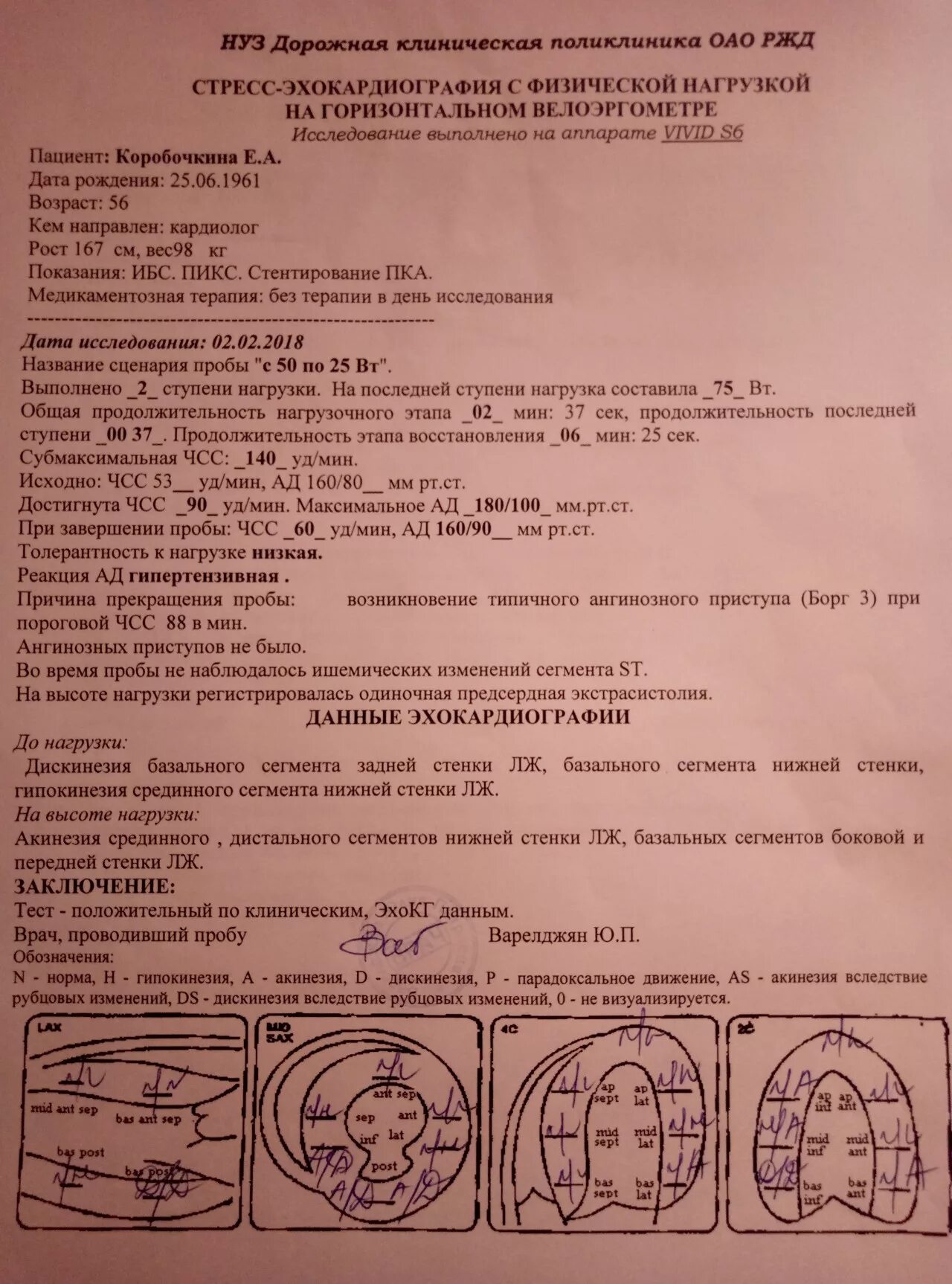 Протокол эхокг. Эхокг заключение. протокол стресс эхокг с физической нагрузкой. протокол эхокардиографии.