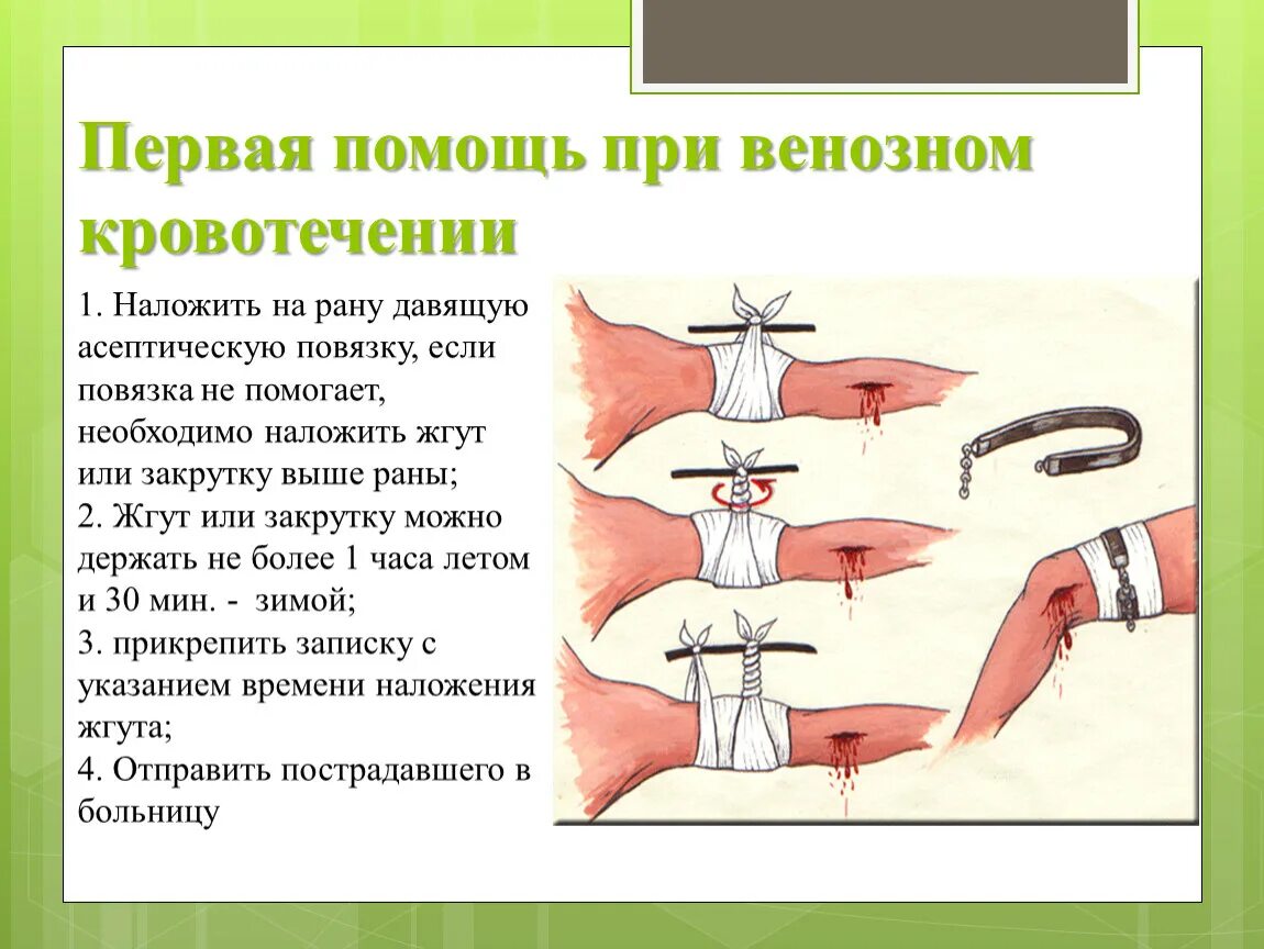 Первая помощь при венозном кровотечении. Оказание первой помощи при венозном кровотечении. Первая помощь при венозном крово. Первая помощь при винозноекровотечение. Эффективный и доступный метод остановки венозного