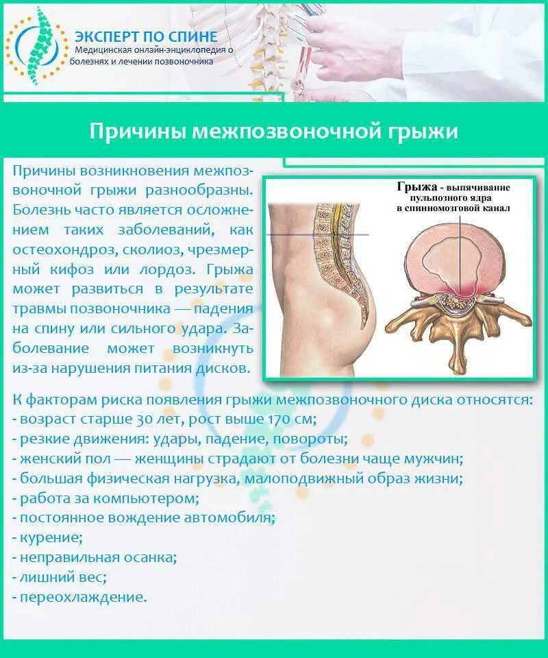 Грыжа поясничного отдела лечение у мужчин симптомы. Грыжа позвоночника с3-с5. Грыжа пояснично-крестцового отдела. Пояснично-крестцовый радикулит симптомы. Межпозвоночная грыжа поясничного отдела.