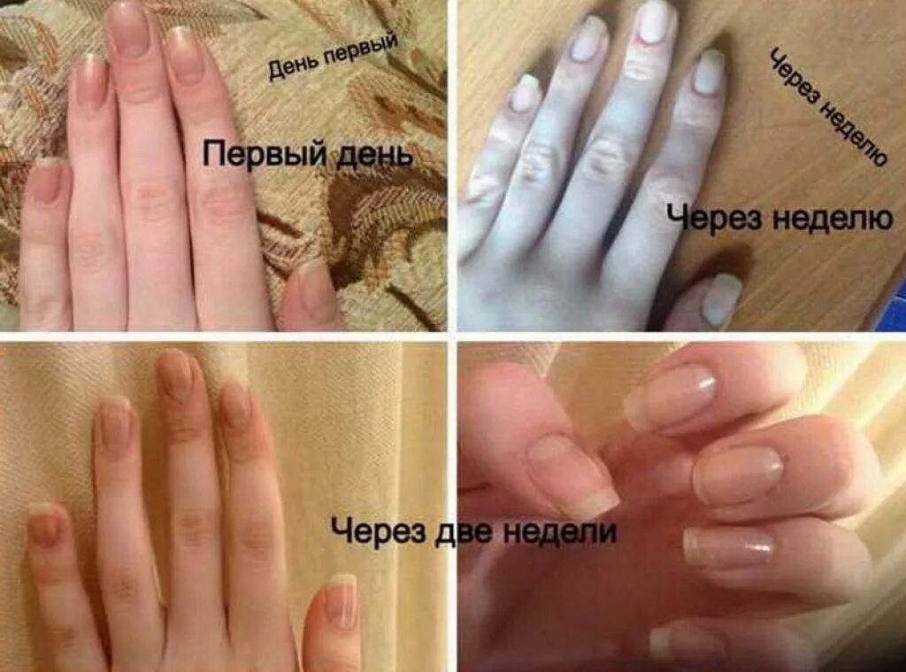 Через сколько вырастет ноготь. Ногти отрастить за месяц. сколько отрастает ноготь на руке.