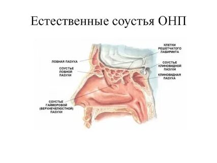 Соустье это