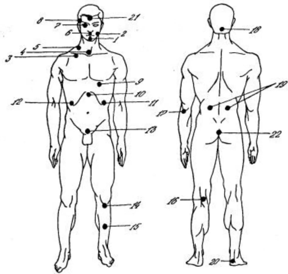 Больные места у человека. Уязвимые точки на теле человека для ударов. Болевые точки и уязвимые места на теле человека. Болевые точки человека схема. Самые уязвимые точки человека.