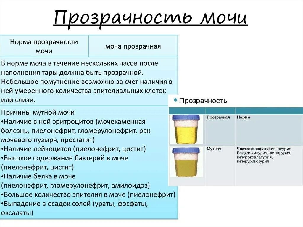 Моча у мужчин. Мутная моча в ОАМ. Прозрачная и мутная моча. Темный цвет мочи. Мутность мочи причины.