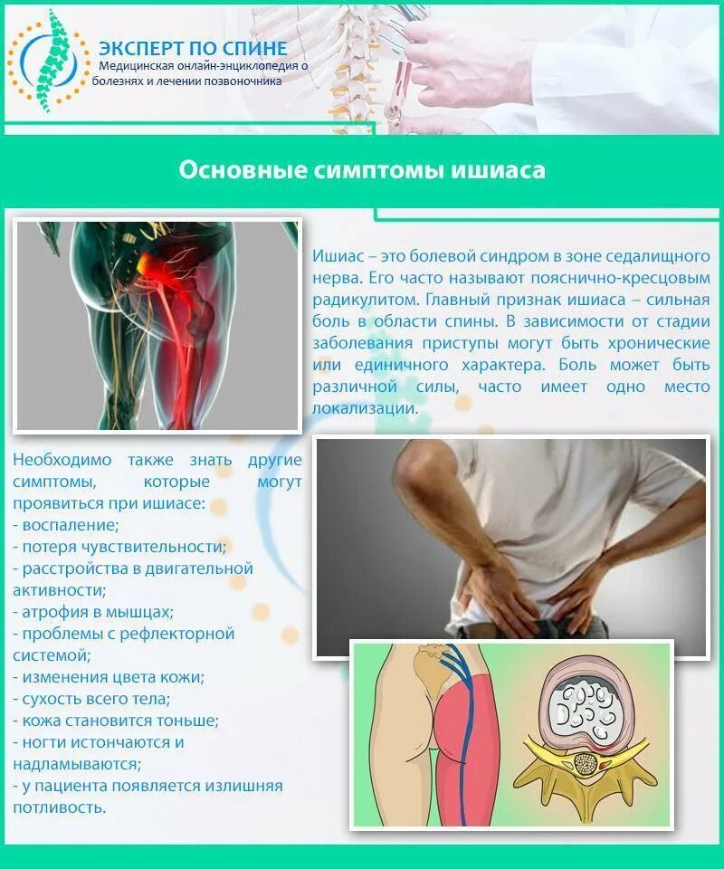 Боли в спине седалищный нерв. Седалищный нерв защемление симптомы мазь. УВЧ терапия седалищного нерва. Невропатия седалищного нерва симптомы. Ишиас тазобедренного сустава симптомы.